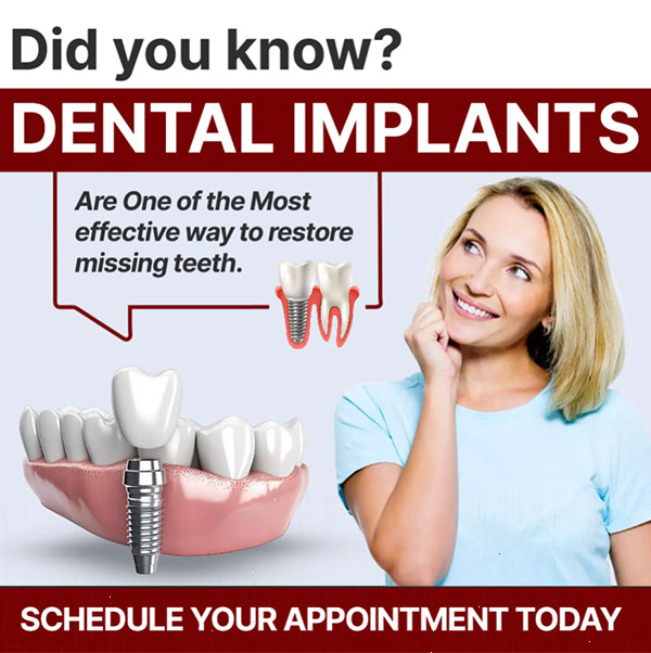 dental implants 3